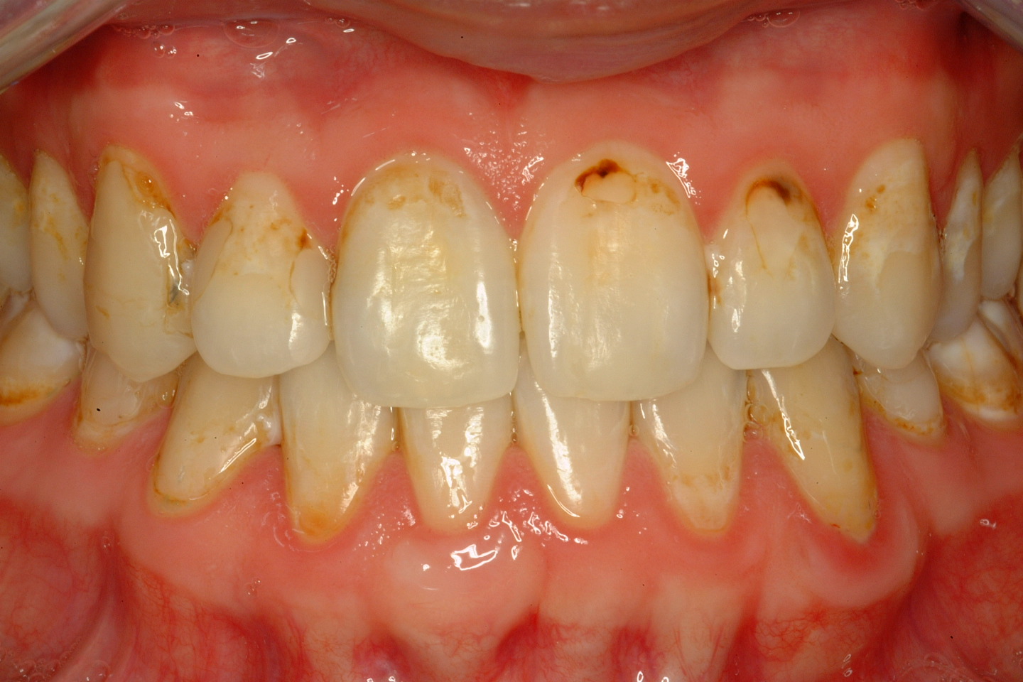 Cosmetic Dentistry