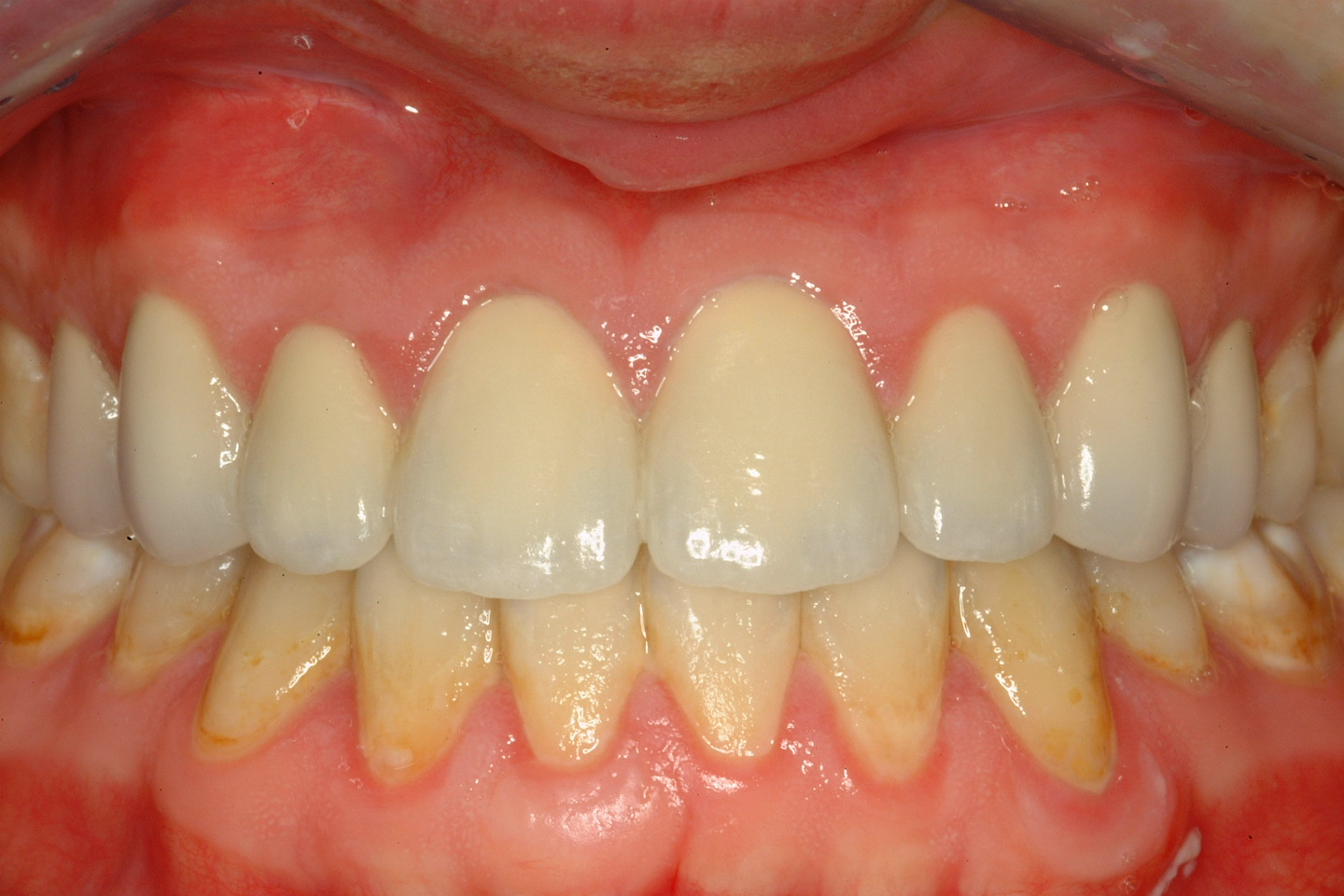 Cosmetic Dentistry