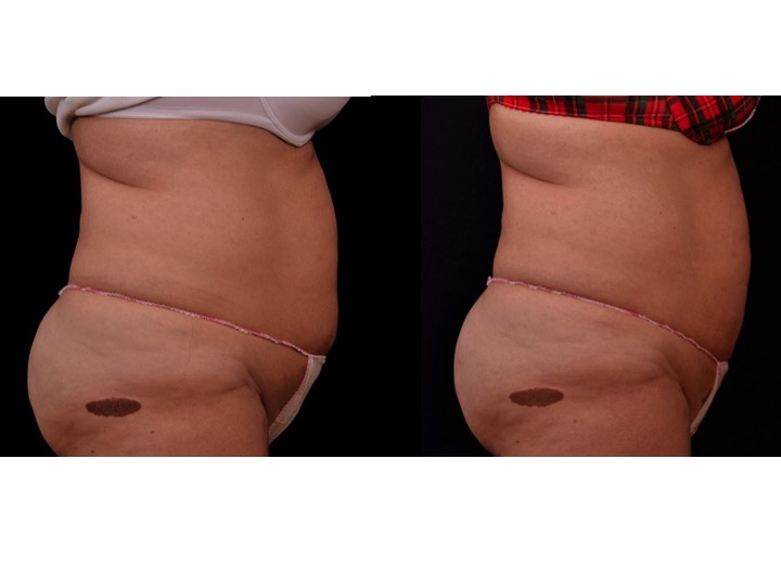 Weight loss center in jeddah picture 8