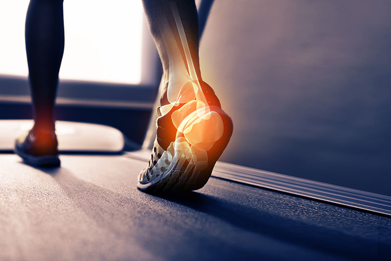 Achilles Tendonitis Specialist Downtown and Midtown New York, NY