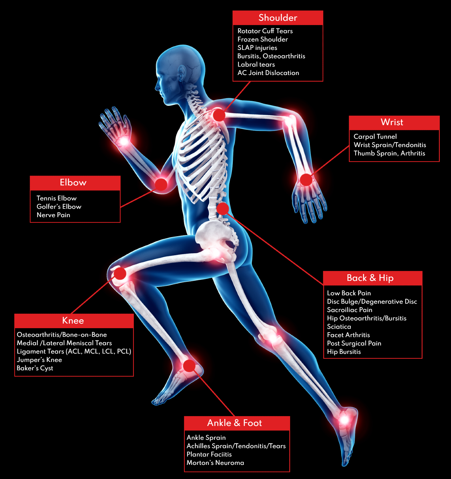 PRP Injections Chicago, AC Joint Glenview