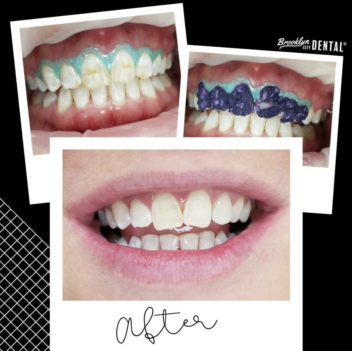 Brooklyn City Dental Cosmetic and General Dentists Greenpoint