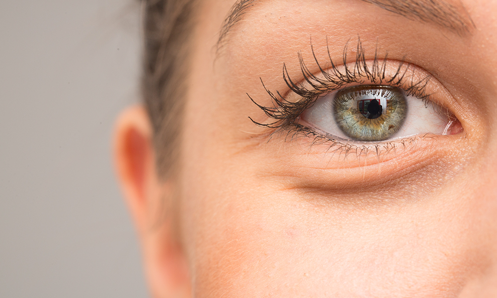 Under Eye Hollows