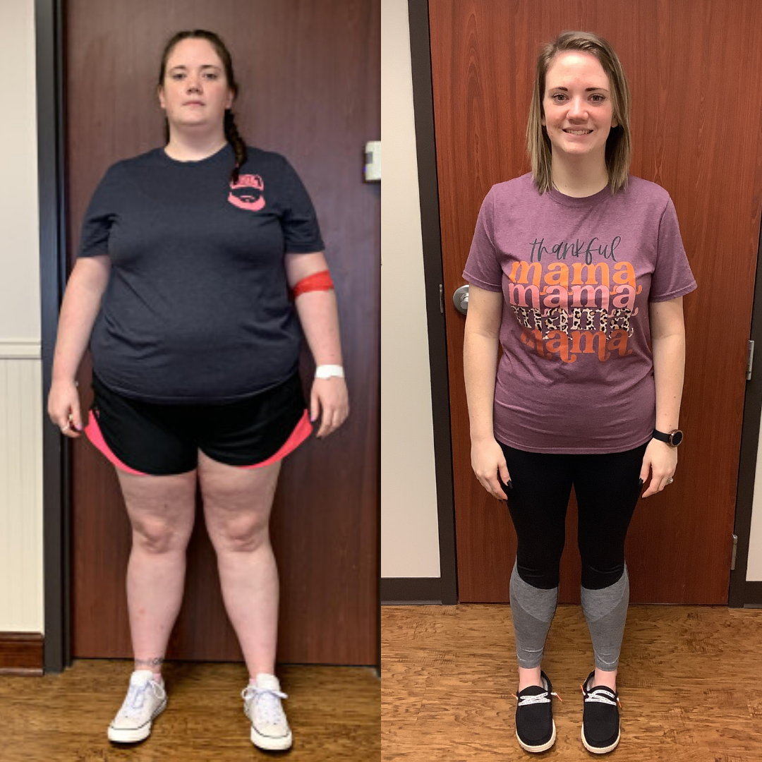 Before and After
