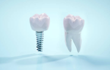 Bruxism Nightguards
