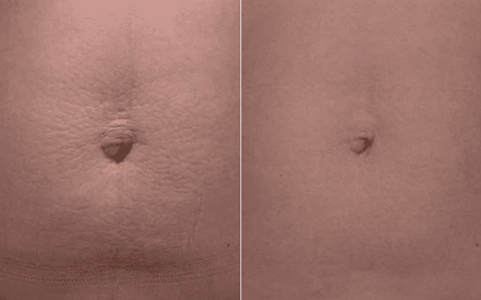 photo of Pure Touch Skin Center