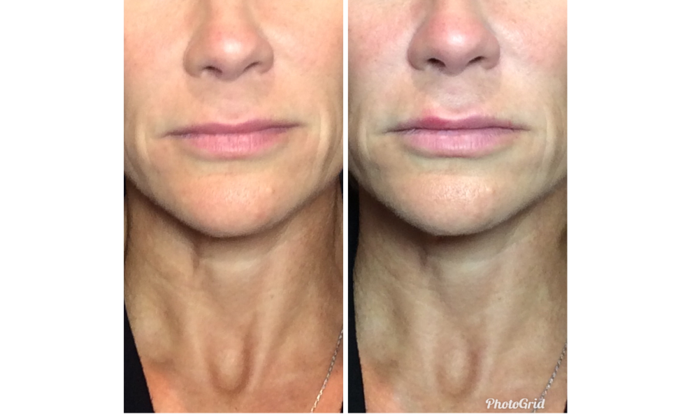 photo of Ageless Expressions MedSpa