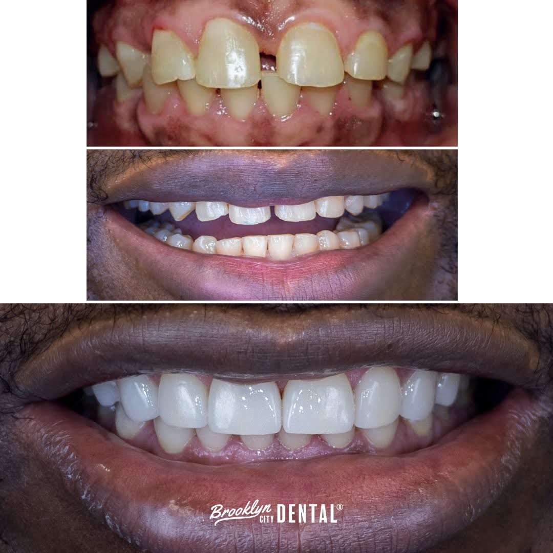 Dentists Open On Sunday Greenpoint Brooklyn, NY Brooklyn, NY