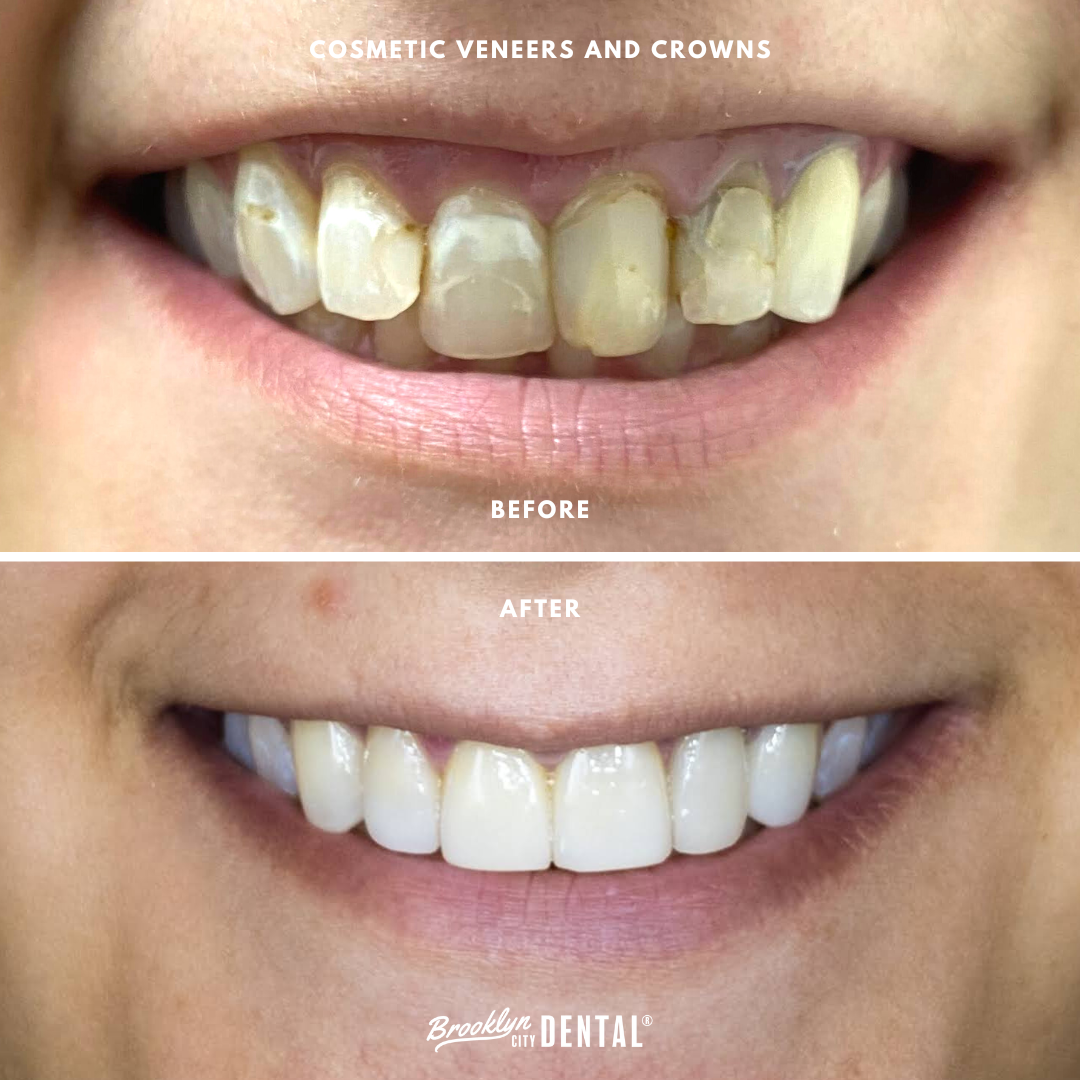 Dentists Open On Sunday Greenpoint Brooklyn, NY Brooklyn, NY