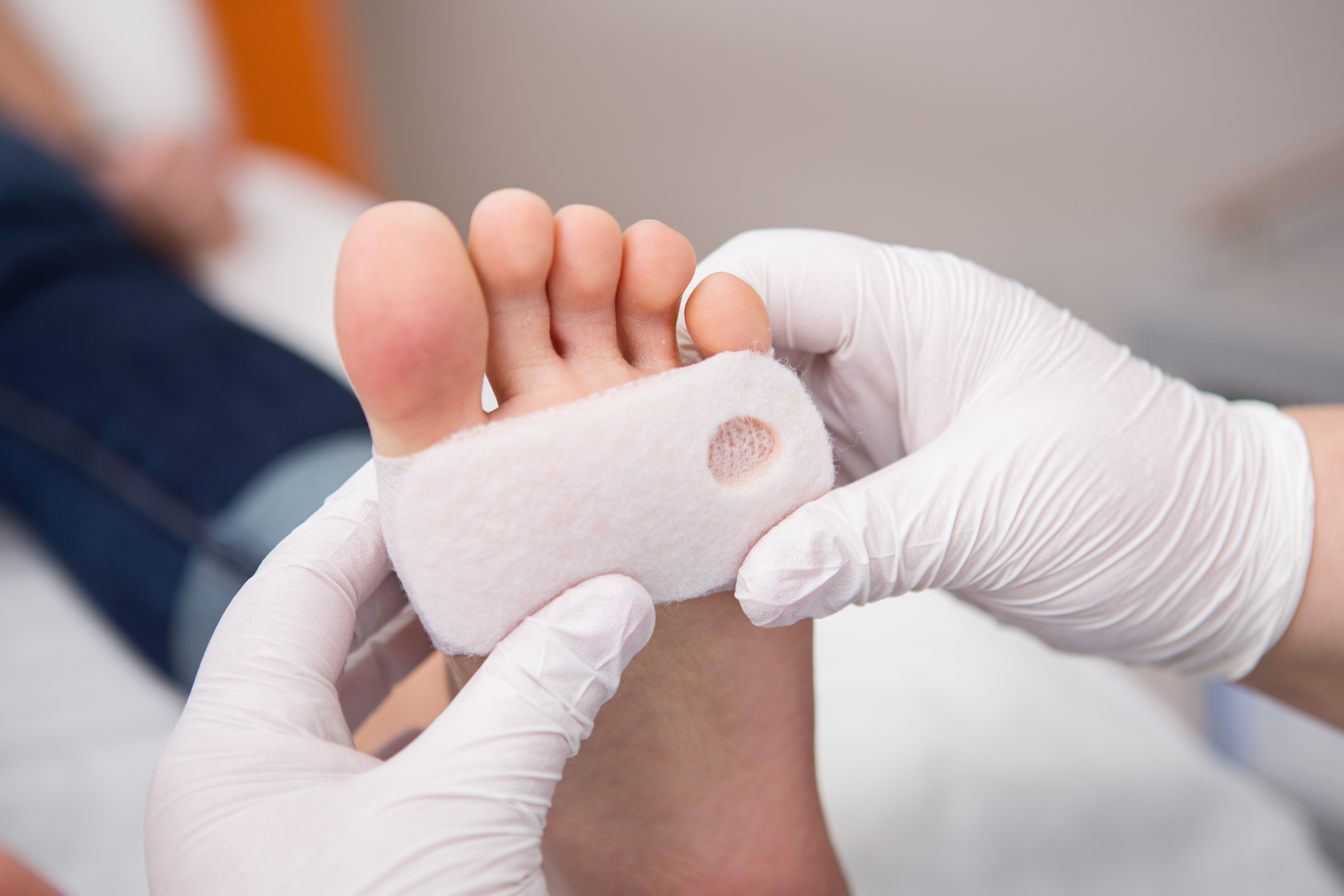 Wound Care