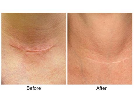 Los Gatos Dermatology Cosmetic Dermatologists Los Gatos Ca Los Gatos Dermatology Cosmetic Dermatologists Los Gatos Ca